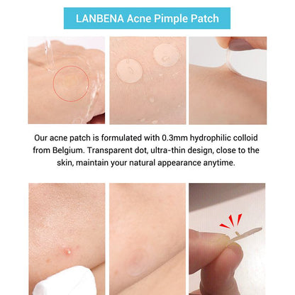 Tea Tree Day & Night Pimple Patches for Acne Marks